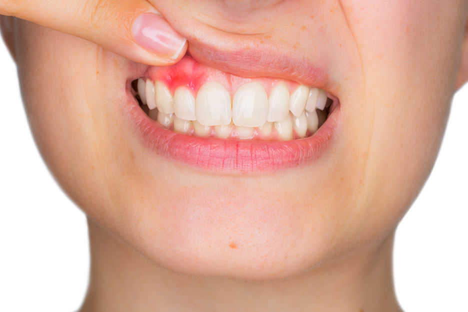 Periodontologia